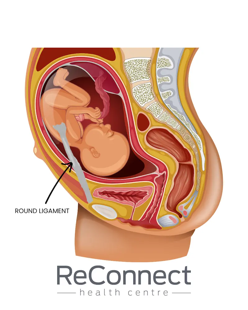 round ligament in pregnancy